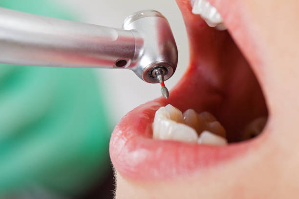 Best Emergency Gum Treatment in Odon, IN